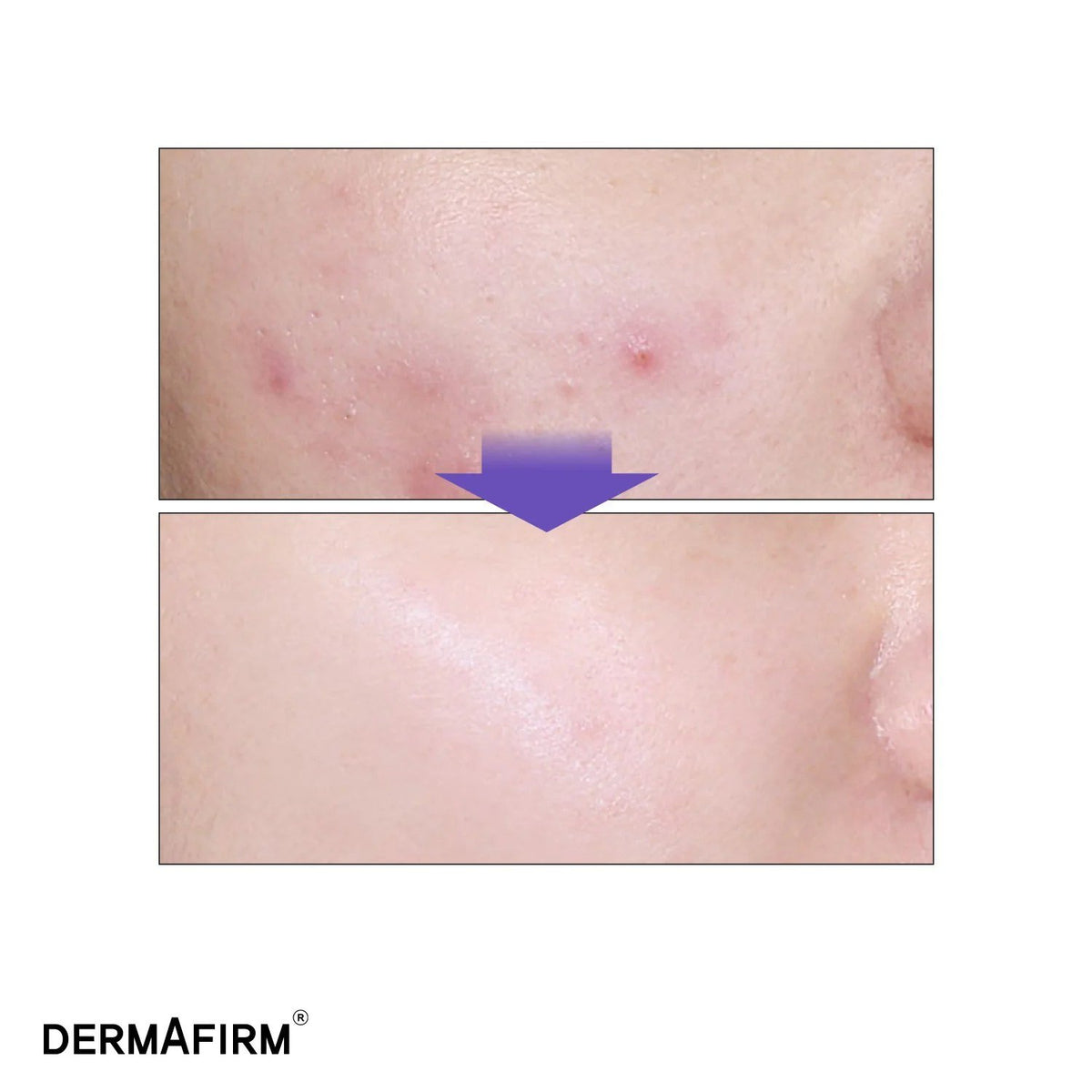DERMAFIRM CICA A.C Serum 30ml