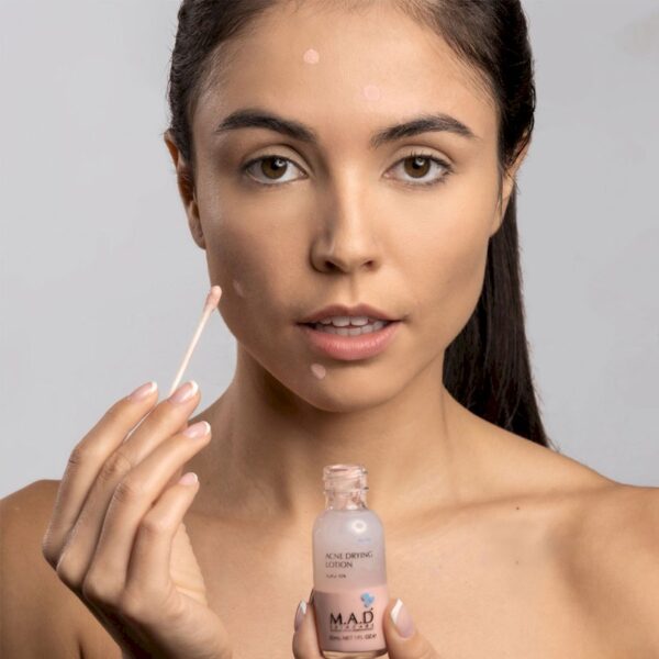 M.A.D Skincare Acne Drying Lotion 30ml